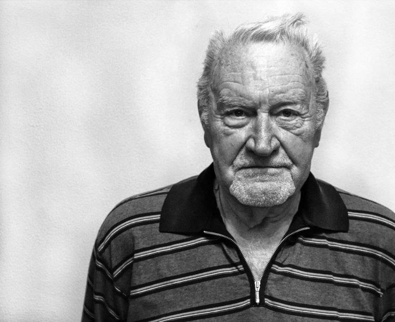 alzheimerda beyin yapısı